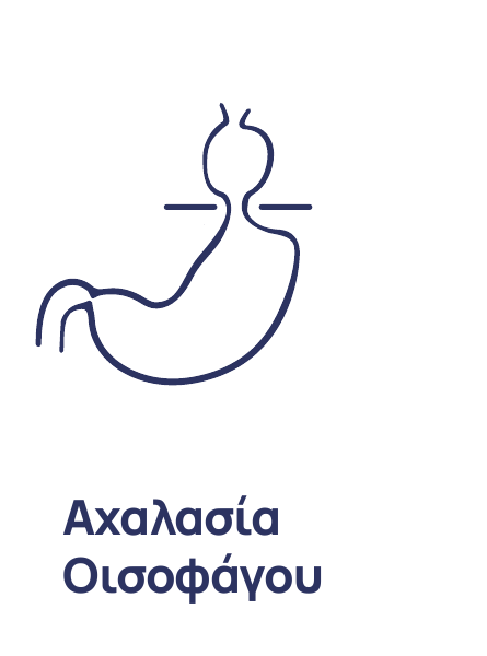 Αχαλασία οισοφάγου