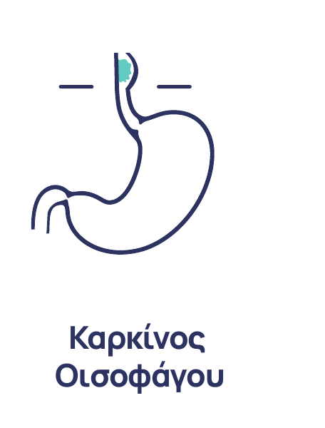Καρκίνος του οισοφάγου