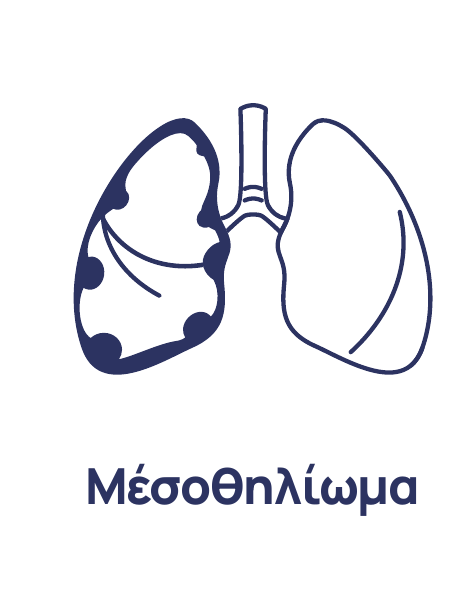 Μεσοθηλίωμα
