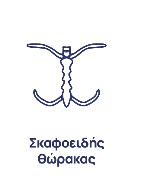 Εισέχον στέρνο (Pectus Excavatum) – Σκαφοειδής θώρακας