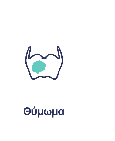 Θύμωμα